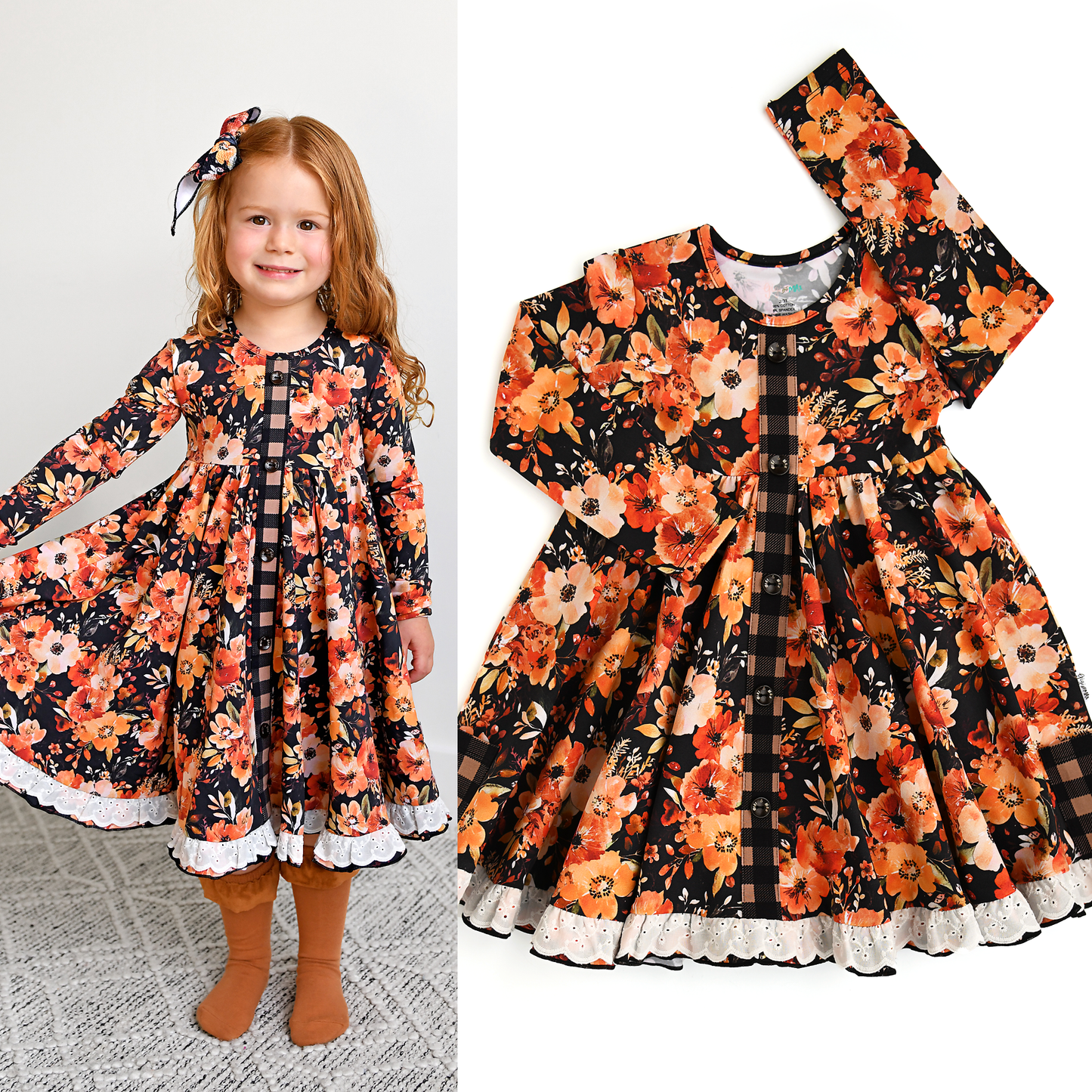 Renee Button Dress